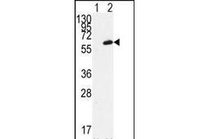 Western blot analysis of FGR (arrow) using FGR Antibody (N-term) (ABIN392096 and ABIN2841848). (Fgr 抗体  (N-Term))