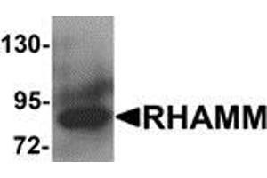 Western blot analysis of RHAMM in rat stomach tissue lysate with RHAMM antibody at 1 μg/ml.
