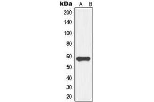 Western blot analysis of GDF9 expression in HL60 (A) whole cell lysates. (GDF9 抗体  (Center))