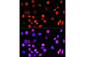 Immunofluorescence (IF) image for anti-Topoisomerase (DNA) I (TOP1) antibody (ABIN7270850)
