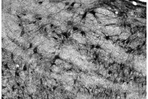 Adult rat medial vestibular nucleus immunohistochemistry.
