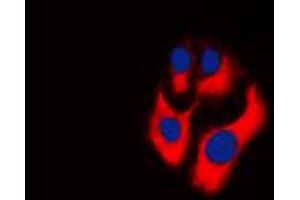 Immunofluorescent analysis of CKMT2 staining in THP1 cells. (CKMT2 抗体  (Center))