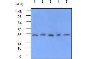 Western Blotting (WB) image for anti-C-Reactive Protein (CRP) (AA 19-224) antibody (ABIN317507) (CRP 抗体  (AA 19-224))