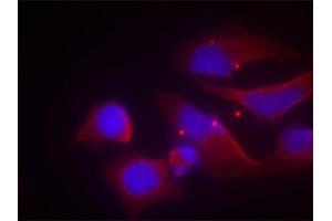 Immunofluorescence staining of methanol-fixed Hela cells using Phospho-GRIN2B-Y1474 antibody. (GRIN2B 抗体  (pTyr1474))