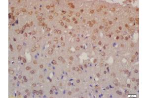 Formalin-fixed and paraffin embedded rat brain labeled with Rabbit Anti-NRG3 Polyclonal Antibody, Unconjugated  at 1:200 followed by conjugation to the secondary antibody and DAB staining (Neuregulin 3 抗体  (AA 351-450))