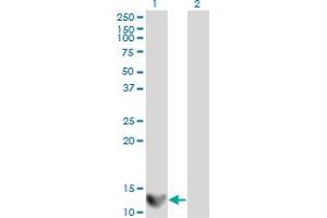 Western Blot analysis of LGALS1 expression in transfected 293T cell line by LGALS1 monoclonal antibody (M01A), clone 1E8-1B2.