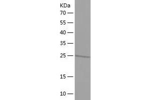 TFAP4 Protein (AA 148-338) (His tag)