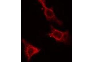 ABIN6275475 staining Hela cells by IF/ICC. (RAP2C 抗体  (Internal Region))