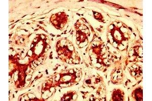 Immunohistochemistry (IHC) image for anti-Stromal Antigen 3 (STAG3) (AA 1056-1212) antibody (ABIN7148050)