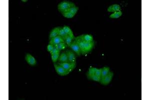 Immunofluorescence staining of HepG2 cells with ABIN7171496 at 1:133, counter-stained with DAPI. (TNKS 抗体  (AA 35-130))
