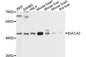 Western blot analysis of extracts of various cells, using SUCLA2 antibody. (SUCLA2 抗体)