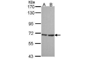 WB Image Sample (30 ug of whole cell lysate) A: Hela B: JurKat 7. (SH3BP1 抗体  (C-Term))