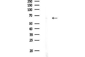 anti-Zinc Finger Protein 768 (ZNF768) (Internal Region) antibody