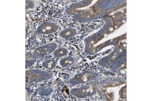 Immunohistochemical staining of human small intestine with CCDC90B polyclonal antibody  shows moderate cytoplasmic positivity at 1:20-1:50 dilution. (CCDC90B 抗体)
