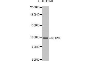 Western blot analysis of extracts of COLO 320 cells tissue, using NUP98 antibody. (NUP98 抗体  (AA 621-920))