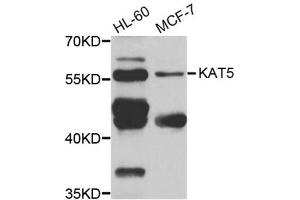 Western blot analysis of extracts of various cell lines, using KAT5 antibody (ABIN6292501) at 1:1000 dilution. (KAT5 抗体)