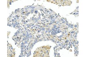 IHC analysis of Endothelin A Receptor/ET-A/ EDNRA using anti-Endothelin A Receptor/ET-A/ EDNRA antibody (ABIN7601308).