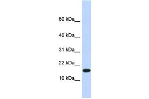 WB Suggested Anti-EGLN2 Antibody Titration:  0. (PHD1 抗体  (N-Term))