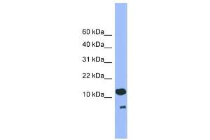 WB Suggested Anti-CDC26 Antibody Titration: 0. (CDC26 抗体  (C-Term))