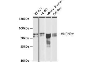Western blot analysis of extracts of various cell lines, using HNRNPM antibody (ABIN6128031, ABIN6141919, ABIN6141920 and ABIN6222681) at 1:1000 dilution.