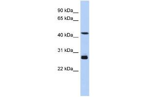 WB Suggested Anti-SYT9 Antibody Titration: 0. (SYT9 抗体  (Middle Region))