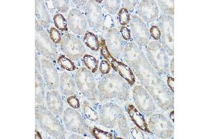 Immunohistochemistry of paraffin-embedded mouse kidney using IP6K1 Rabbit pAb (ABIN6131922, ABIN6142500, ABIN6142501 and ABIN6215821) at dilution of 1:100 (40x lens). (IP6K1 抗体  (AA 1-220))