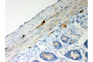 Immunohistochemistry (IHC) image for anti-ATP Synthase, H+ Transporting, Mitochondrial Fo Complex, Subunit D (ATP5H) (AA 2-161) antibody (ABIN3043795)