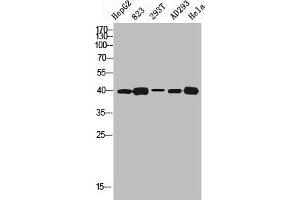 Western blot analysis of HEPG2 823 293T AD293 HELA using SR-1D antibody. (5HT1D 抗体  (Internal Region))
