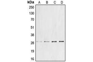 Western blot analysis of Cyclin G1 expression in DLD (A), Jurkat (B), mouse liver (C), rat liver (D) whole cell lysates. (Cyclin G1 抗体  (Center))