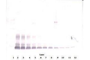 Image no. 3 for anti-PDGF-BB Homodimer antibody (ABIN465590) (PDGF-BB Homodimer 抗体)