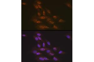 Immunofluorescence analysis of U-2 OS cells using Transportin 3 (Transportin 3 (TNPO3)) Rabbit mAb (ABIN7270971) at dilution of 1:100 (40x lens). (Transportin 3 抗体)