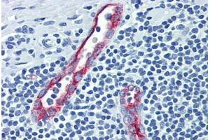 Human Tonsil (formalin-fixed, paraffin-embedded) stained with SELP antibody ABIN462342 followed by biotinylated anti-mouse IgG secondary antibody ABIN481714, alkaline phosphatase-streptavidin and chromogen. (P-Selectin 抗体)