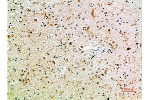 Immunohistochemical analysis of paraffin-embedded human-brain, antibody was diluted at 1:200 (CD16a, CD16b (AA 100-150) 抗体)