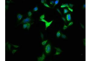 Immunofluorescence staining of HepG2 cells with ABIN7154014 at 1:133, counter-stained with DAPI. (GLS2 抗体  (AA 15-602))