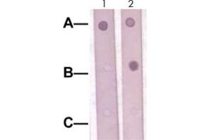 Dot Blot : 1 ug peptide was blot onto NC membrane. (SOX9 抗体  (Ser181))