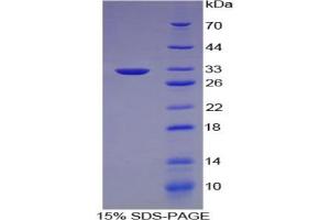 SDS-PAGE analysis of Mouse Lipase, Endothelial Protein. (LIPG 蛋白)