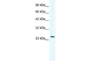 WB Suggested Anti-TCF7 Antibody Titration:  0.