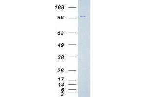FAK Protein (Transcript Variant 1) (Myc-DYKDDDDK Tag)