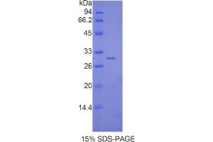 SDS-PAGE analysis of Mouse IL17RD Protein. (IL17RD 蛋白)