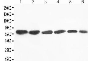 Anti-Flavin containing monooxygenase 4 antibody, Western blotting Lane 1: Rat Liver Tissue Lysate Lane 2: Mouse Liver Tissue Lysate Lane 3: SMMC Cell Lysate Lane 4: HEPA Cell Lysate Lane 5: A431 Cell Lysate Lane 6: MCF-7 Cell Lysate