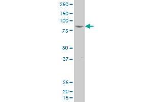 FLJ13149 polyclonal antibody (A01), Lot # 060613JCS1 Western Blot analysis of FLJ13149 expression in HL-60 . (FASTKD5 抗体  (AA 671-764))