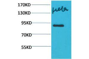 Western Blotting (WB) image for anti-Signal Transducer and Activator of Transcription 4 (STAT4) antibody (ABIN3181592) (STAT4 抗体)
