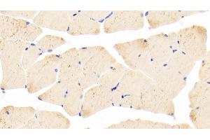 Detection of KEAP1 in Mouse Skeletal muscle Tissue using Polyclonal Antibody to Kelch Like ECH Associated Protein 1 (KEAP1) (KEAP1 抗体  (AA 1-286))