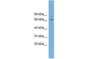 WB Suggested Anti-SNAG1 Antibody Titration: 0. (SNX18 抗体  (C-Term))