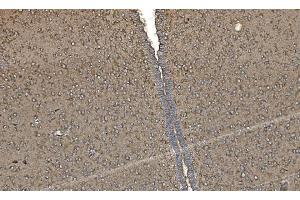IHC analysis of FABP-1/GOT2 using anti-FABP-1/GOT2 antibody (ABIN7601426). (GOT2 抗体  (AA 35-430))