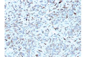 Formalin-fixed, paraffin-embedded human Kidney stained with C1QA Mouse Monoclonal Antibody (C1QA/2952). (C1QA 抗体  (AA 104-237))