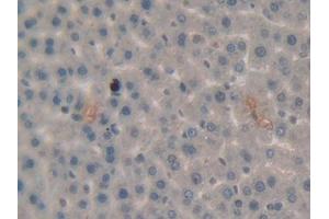 IHC-P analysis of Rat Liver Tissue, with DAB staining. (PLG 抗体  (AA 191-433))
