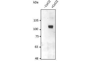 Anti-HIF1α Ab at 2,500 dilution, HT1080 cells in the presence of COCl lysate at 100 µg per Iane, rabbit polyclonal to goat lgG (HRP) at 1/10,000 dilution, (HIF1A 抗体  (C-Term))