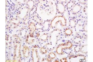 Formalin-fixed and paraffin embedded rat kidney labeled with Rabbit Anti PAI-1 Polyclonal Antibody, Unconjugated (ABIN733223) at 1:200 followed by conjugation to the secondary antibody and DAB staining (PAI1 抗体  (AA 301-402))