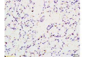 Formalin-fixed and paraffin embedded rat lung tissue labeled with Anti-EPOR Polyclonal Antibody , Unconjugated at 1:200 followed by conjugation to the secondary antibody and DAB staining (EPOR 抗体  (AA 301-450))